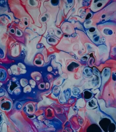 Serverless is Ready, Developers Are Not